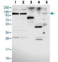 Anti-CACTIN Rabbit Polyclonal Antibody