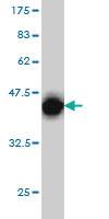 Anti-CRX Mouse Monoclonal Antibody [clone: 4G11]