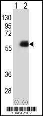 Anti-NMT2 Rabbit Polyclonal Antibody (AP (Alkaline Phosphatase))