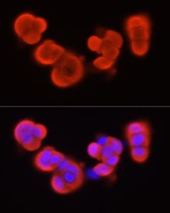 Immunofluorescence analysis of MCF7 cells using Anti-S100A11 Antibody (A306920) at a dilution of 1:50 (40x lens). DAPI was used to stain the cell nuclei (blue)