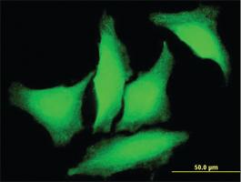 Anti-PKD2 Mouse Monoclonal Antibody [clone: 4C8]