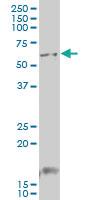 Anti-GCM1 Mouse Monoclonal Antibody [clone: 4E8]