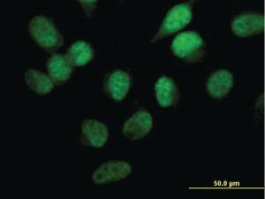 Anti-STK33 Mouse Monoclonal Antibody [clone: 6G1]