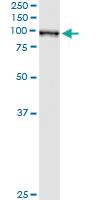 Anti-QARS Antibody Pair