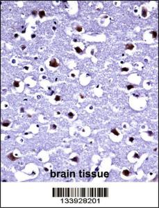 Anti-TARBP2 Rabbit Polyclonal Antibody (APC (Allophycocyanin))