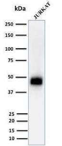 Anti-CD2 Mouse Monoclonal Antibody [clone: UMCD2]