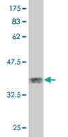 Anti-ZNF7 Mouse Monoclonal Antibody [clone: 6F2]