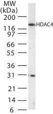 Anti-HDAC4 Rabbit Polyclonal Antibody