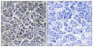 Immunohistochemical analysis of paraffin-embedded human pancreas tissue using Anti-PPM1K Antibody. The right hand panel represents a negative control, where the Antibody was pre-incubated with the immunising peptide