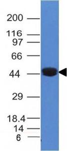 Anti-Cytokeratin 8 antibody