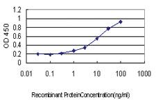 Anti-ATP2A3 Mouse Monoclonal Antibody [clone: 2H3]