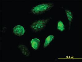 Anti-GCM1 Mouse Monoclonal Antibody [clone: 4E8]