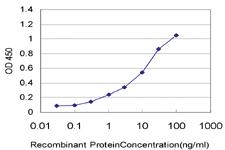 Anti-PKD2 Mouse Monoclonal Antibody [clone: 4C8]