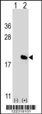 Anti-IL17A Rabbit Polyclonal Antibody