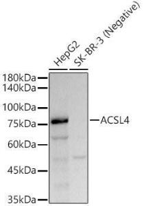 Anti-FACL4 Rabbit Monoclonal Antibody [clone: ARC53209]