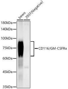 Anti-CD116 Rabbit Monoclonal Antibody [clone: ARC59284]