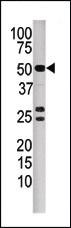 Anti-PPP3CB Rabbit Polyclonal Antibody