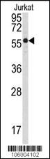 Anti-PPP3CB Rabbit Polyclonal Antibody