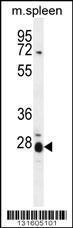 Anti-IL17B Rabbit Polyclonal Antibody (AP (Alkaline Phosphatase))