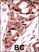 Anti-PPP3CB Rabbit Polyclonal Antibody