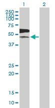 Anti-PKLR Mouse Polyclonal Antibody