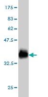 Anti-GALNT6 Mouse Monoclonal Antibody [clone: 4C10]