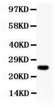 Anti-Cyclin D3 Polyclonal Antibody