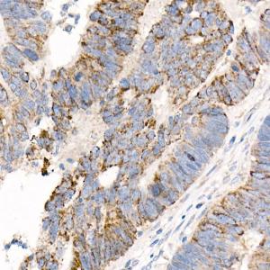 Anti-FACL4 Rabbit Monoclonal Antibody [clone: ARC53209]