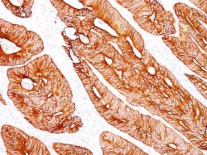 Anti-Cytokeratin 8 antibody