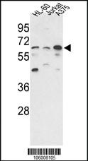 Anti-PPP3CC Rabbit Polyclonal Antibody