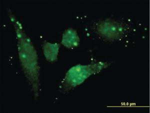 Anti-FGFR2 Mouse Monoclonal Antibody [clone: 2C11]