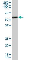 Anti-PKLR Mouse Polyclonal Antibody