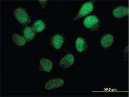 Anti-STK33 Mouse Monoclonal Antibody [clone: 6G1]