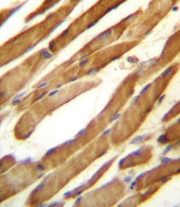 Anti-SLC16A10 Rabbit Polyclonal Antibody (PE (Phycoerythrin))