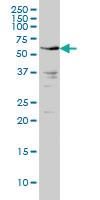 Anti-IRAK2 Mouse Monoclonal Antibody [clone: 1A6]