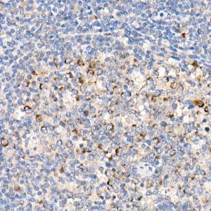 Anti-FACL4 Rabbit Monoclonal Antibody [clone: ARC53209]