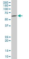 Anti-IRAK2 Mouse Monoclonal Antibody [clone: 1A6]