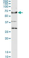 Anti-IL18R1 Polyclonal Antibody Pair