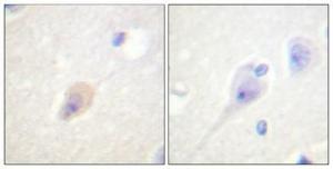 Immunohistochemical analysis of paraffin-embedded human brain using Anti-DARPP-32 (phospho Thr75) Antibody 1:100 (4°C overnight). The right hand panel represents a negative control, where the antibody was pre-incubated with the immunising peptide