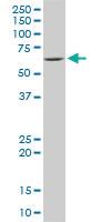 Anti-IRAK2 Mouse Monoclonal Antibody [clone: 1A6]