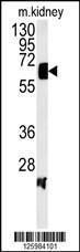 Anti-ATP6V1H Rabbit Polyclonal Antibody (FITC (Fluorescein Isothiocyanate))