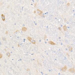 Anti-FACL4 Rabbit Monoclonal Antibody [clone: ARC53209]