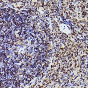 Immunohistochemistry analysis of paraffin-embedded mouse spleen using Anti-MEF2A + MEF2C Antibody [ARC2661] (A308083) at a dilution of 1:100 (40X lens). Perform high pressure antigen retrieval with 10 mM citrate buffer pH 6.0 before commencing with IHC staining protocol