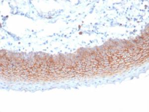 Immunohistochemical analysis of formalin-fixed, paraffin-embedded human tonsil tissue using Anti-Syndecan 1 Antibody [SDC1/7180]