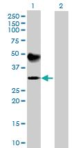 Anti-ATP4B Mouse Polyclonal Antibody