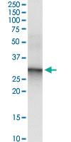 Anti-CACNG6 Polyclonal Antibody Pair