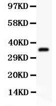 Anti-ATF1 Polyclonal Antibody