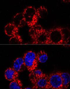 Anti-FACL4 Rabbit Monoclonal Antibody [clone: ARC53209]