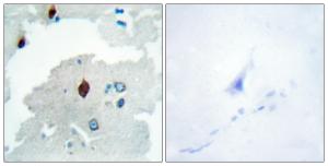 Immunohistochemical analysis of paraffin-embedded human brain tissue using Anti-PTTG Antibody. The right hand panel represents a negative control, where the antibody was pre-incubated with the immunising peptide