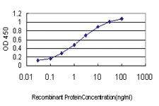 Anti-IRAK2 Mouse Monoclonal Antibody [clone: 1A6]